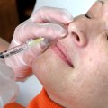 The Benefits of Dermal Fillers: A Comprehensive Guide