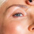 Do fillers cause hard lumps under the skin?