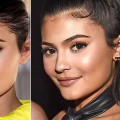 Does your face return to normal after fillers?