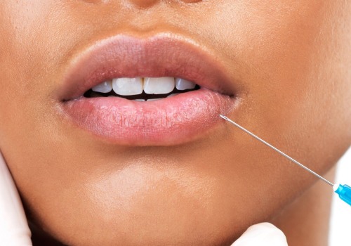 Can you dissolve some filler and not all?