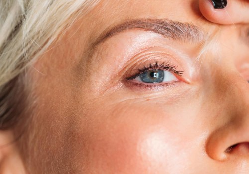 Do fillers cause hard lumps under the skin?