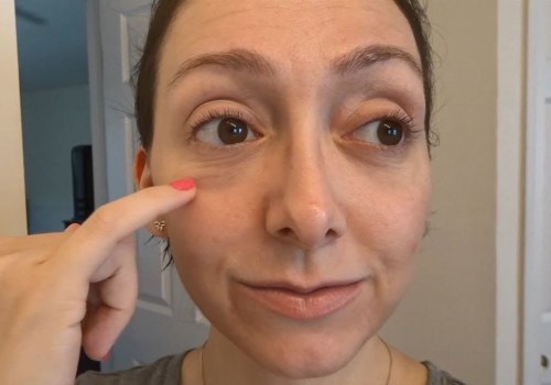 Can cheek fillers reduce under-eye bags?