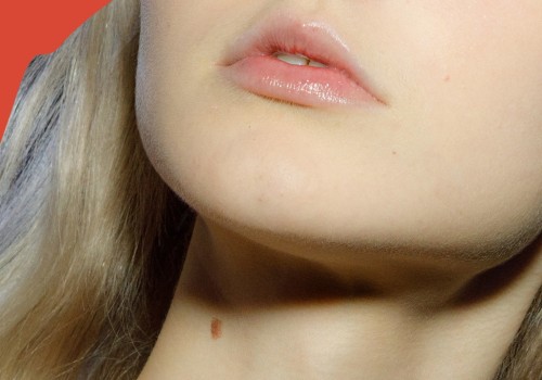 Do dermal fillers expand? an expert's perspective